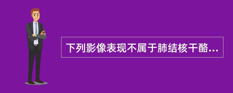 下列影像表现不属于肺结核干酪性病灶的是