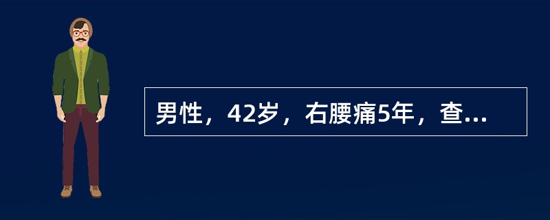 男性，42岁，右腰痛5年，查B超示右肾中度积水；腹部平片可见右中段输尿管有一直径2cm结石，肾盂静脉造影，左肾显示正常，右肾盏显示扩张，肾盂未显示，行右肾穿刺造影右肾中度积水，输尿管上段扩张2cm，结