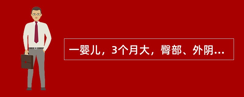 一婴儿，3个月大，臀部、外阴、大腿部出现密集分布的粟粒大小丘疹，伴有小水疱，并逐渐出现渗出和糜烂，边界不清，最可能的诊断是