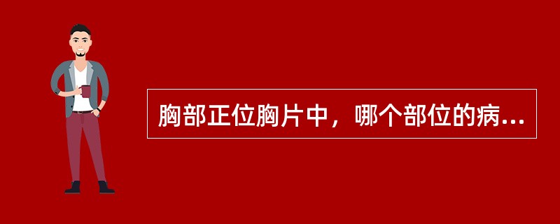 胸部正位胸片中，哪个部位的病变不易被观察到