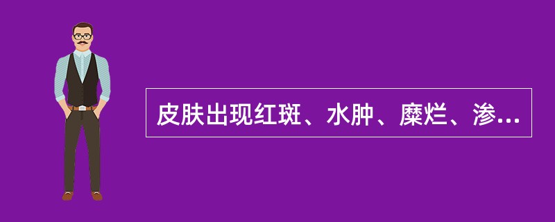 皮肤出现红斑、水肿、糜烂、渗液，外用药首选