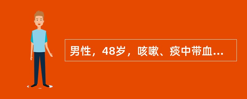 男性，48岁，咳嗽、痰中带血伴右侧胸痛3周就诊，临床和影像学诊断右下肺叶中央型肺癌经检查确诊为小细胞肺癌，首先选择的治疗应是