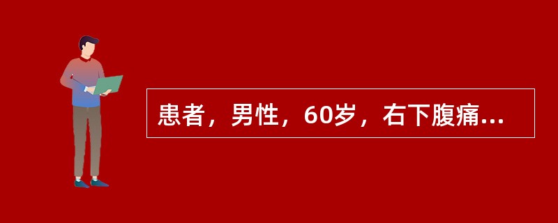 患者，男性，60岁，右下腹痛3个月，有时腹泻，大便隐血试验阳性。钡剂灌肠检查显示升结肠中段一不规则形充盈缺损，局部管壁僵硬，结肠袋消失。最有可能的诊断为