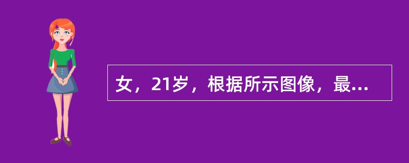 女，21岁，根据所示图像，最可能的诊断是