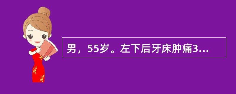 男，55岁。左下后牙床肿痛3天。检查：左下第一磨牙颊侧牙龈处有局限性肿胀、隆起，扪有波动感，该牙未见龋坏，温度测验有感觉，反应与对照牙相同，颊侧近中及中央处探诊深度7mm。最可能的诊断为( )