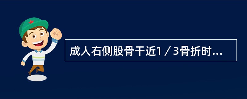 成人右侧股骨干近1／3骨折时近折段主要移位方式是()