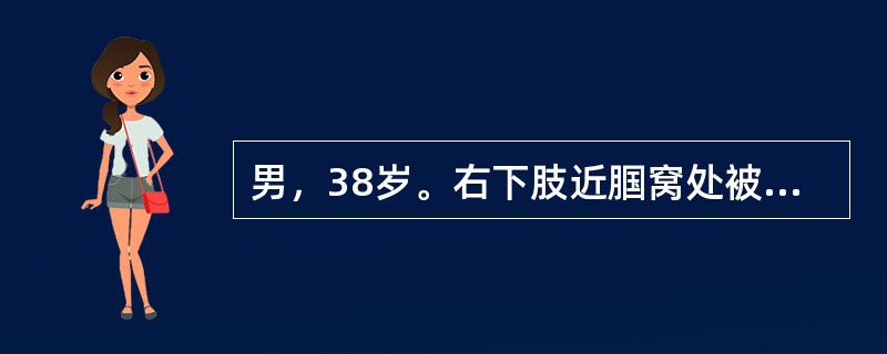男，38岁。右下肢近腘窝处被刀刺伤后出现搏动性肿块，逐渐增大伴右下肢麻木，查右下肢苍白，胭窝部搏动性肿块大小为5cm×4cm，附近有收缩期杂音，诊断为()